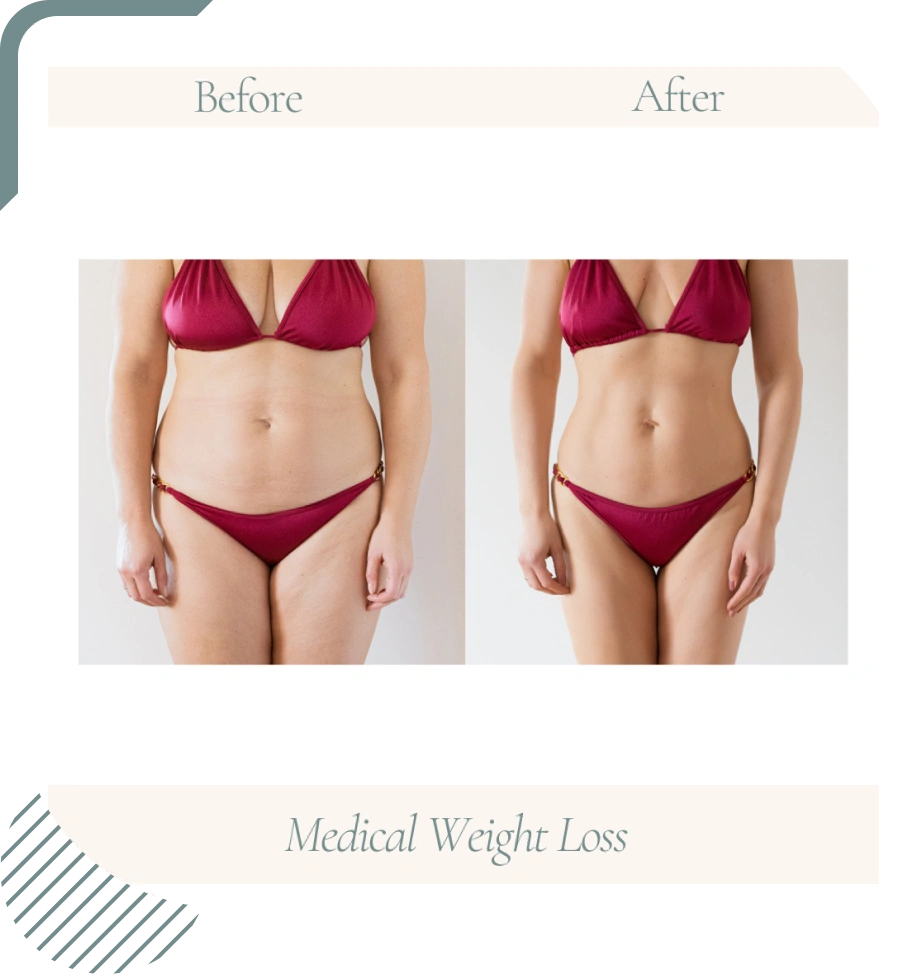 Candidate-Medical-Weight-Loss-new-img